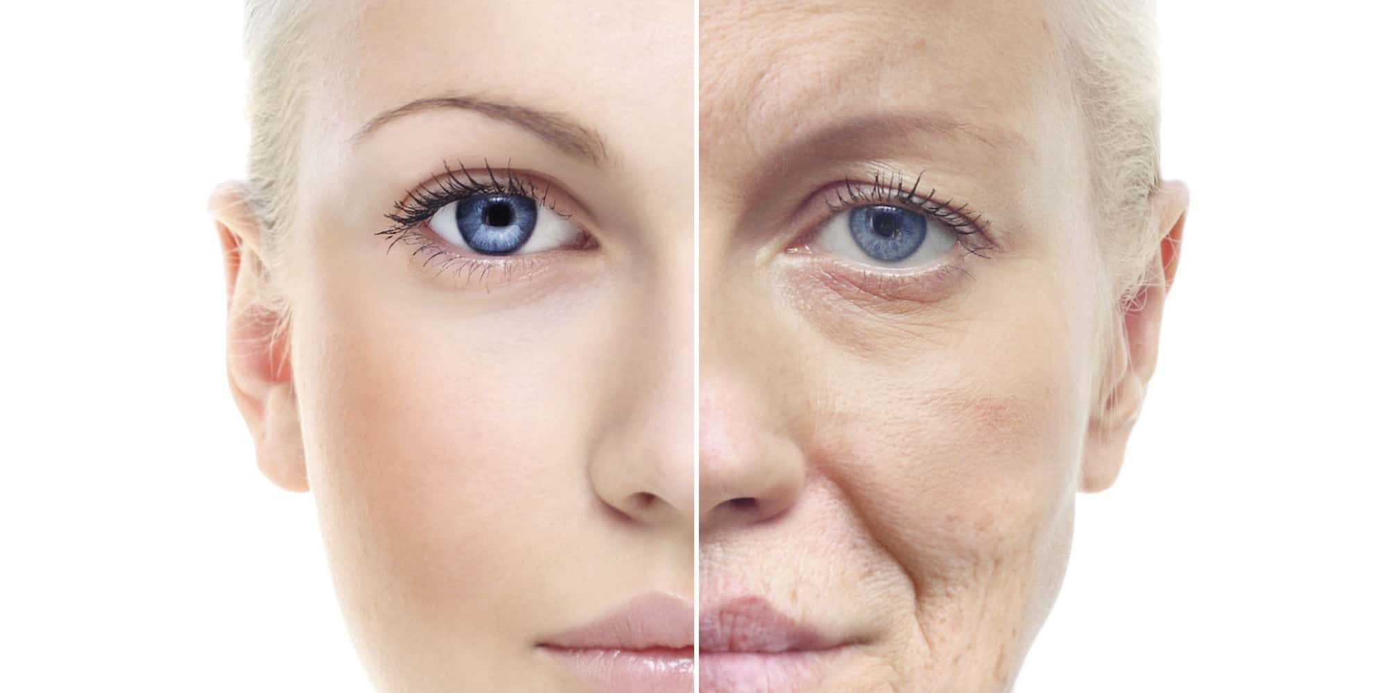 Skin Tightening With Embrace RF Technology For Anti-Ageing Benefits